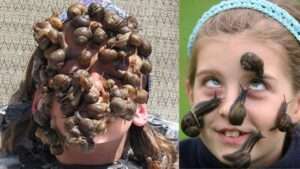 Most Snails on a Face